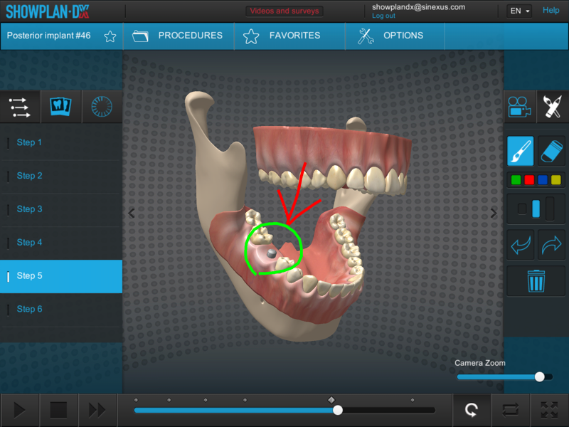 showplan-dx - dental