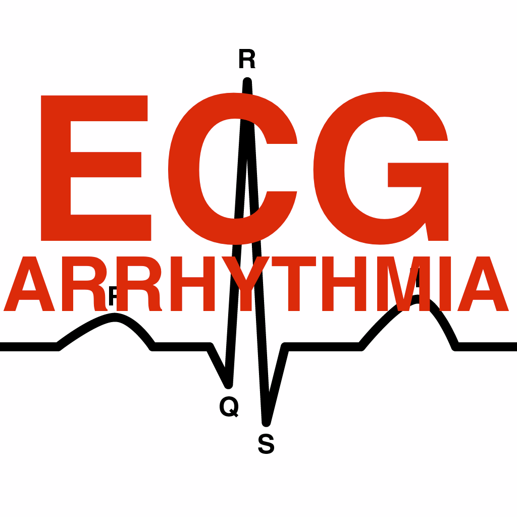 ECG ARRHYTHMIA icon