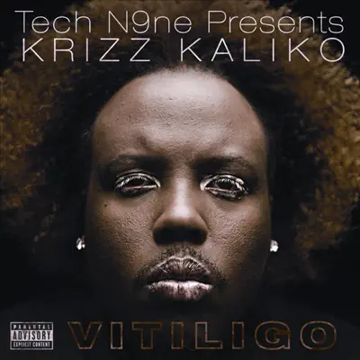 Vitiligo - Tech N9ne