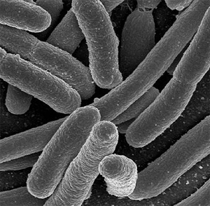 002 Microbes, the little guys_SAR11 the most abundant microbe on the planet!