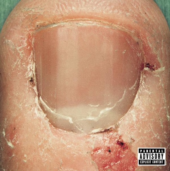 Cover artwork for Rake