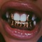 Gold Teeth - KIDLOVO lyrics