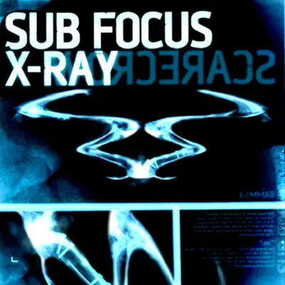 X Ray - Single - Sub Focus