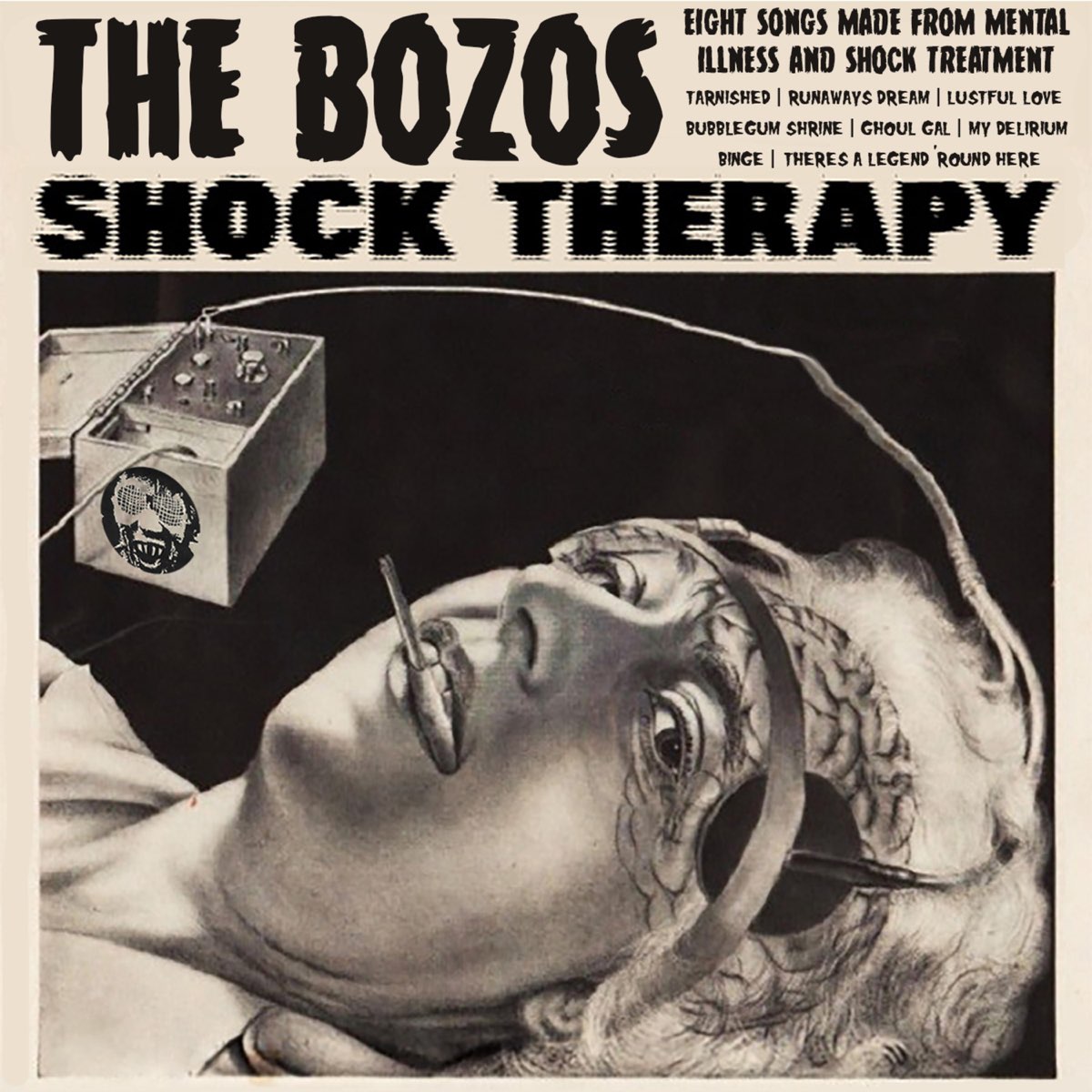 electroshock therapy 1950s