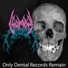 Only Dental Records Remain - Single