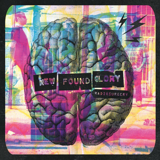 Cover artwork for Radiosurgery