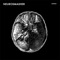 Depression Post Mortem - Honzo lyrics