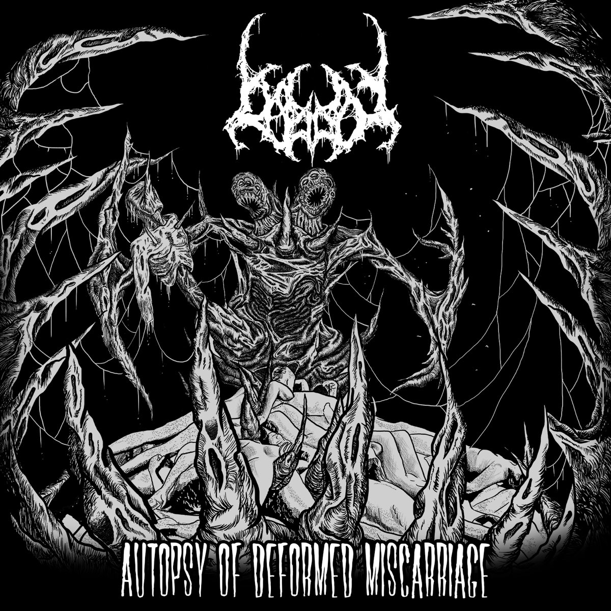 autopsy-of-deformed-miscarriage-single-by-bigot-on-apple-music