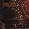 Cancer - Single