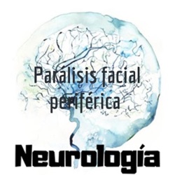 Parálisis facial periférica 