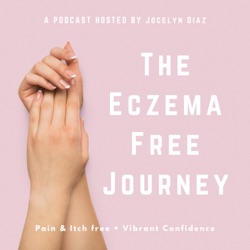 #146- 10 Lifestyle Changes To Improve Your Eczema