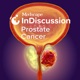 Medscape InDiscussion: Prostate Cancer