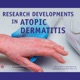 Research Developments in Atopic Dermatitis