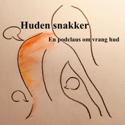 Episode 28 : Hidrosadenitis suppurativa (HS)  (II) Alt om behandling