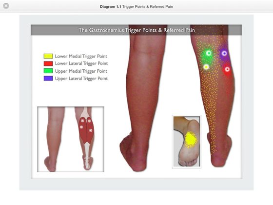 â žtrigger Point Therapy For The Gastrocnemius On Apple Books â žtrigger Point Therapy For The Gastrocnemius On Apple Books