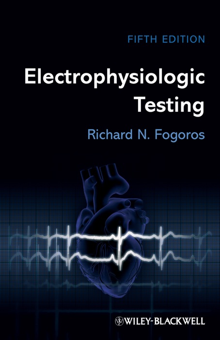 Electrophysiologic Testing