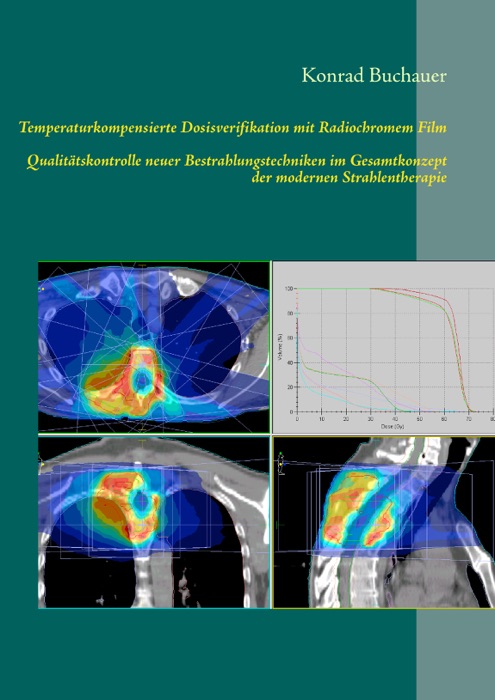 Temperaturkompensierte Dosisverifikation mit Radiochromem Film