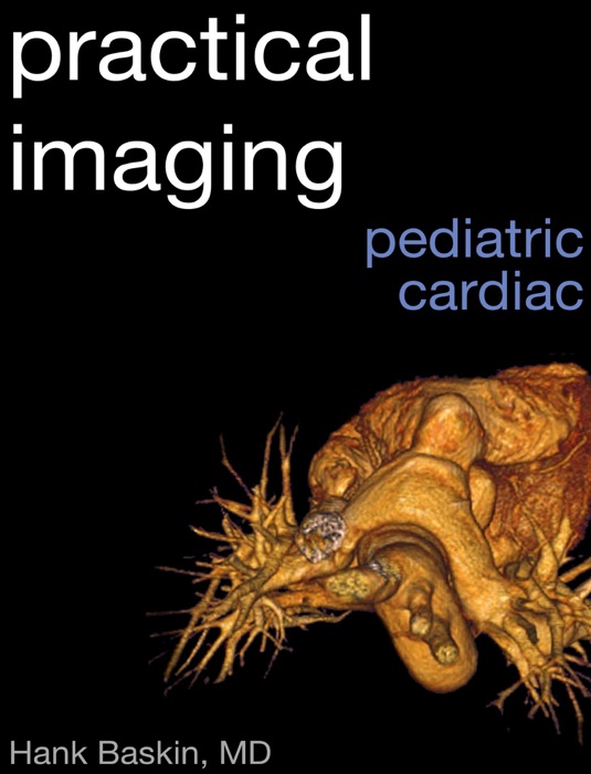 Practical Pediatric Cardiac Imaging