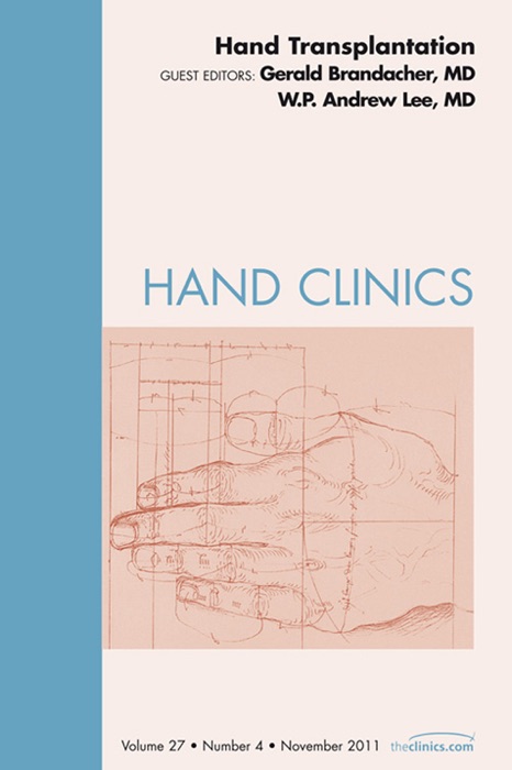 Hand Transplantation, An Issue of Hand Clinics - E-Book