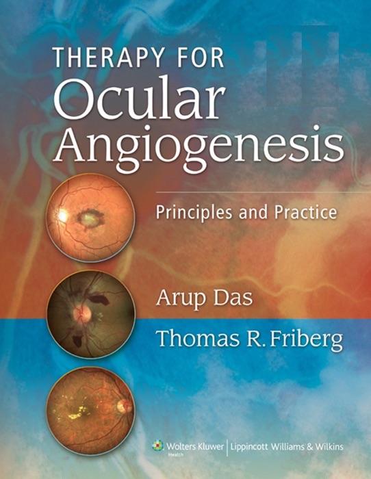 Therapy for Ocular Angiogenesis