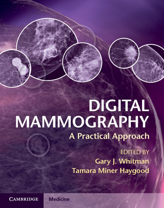 Digital Mammography