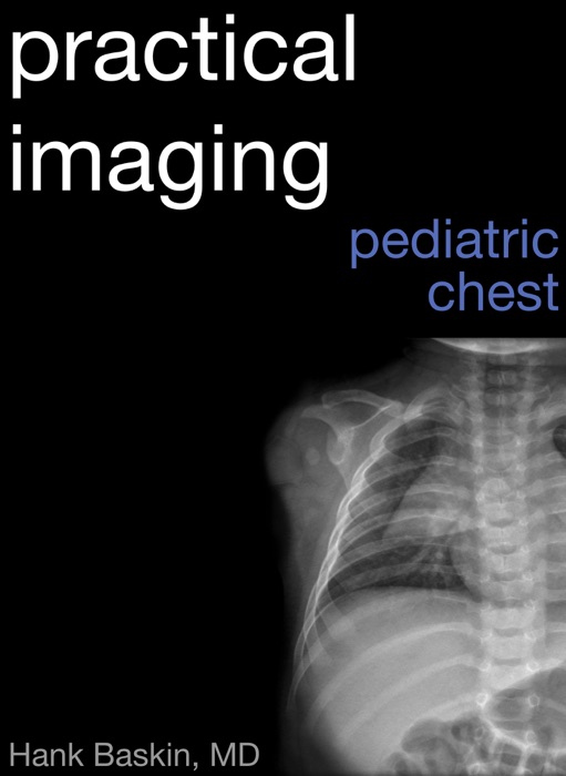 Practical Pediatric Chest Imaging