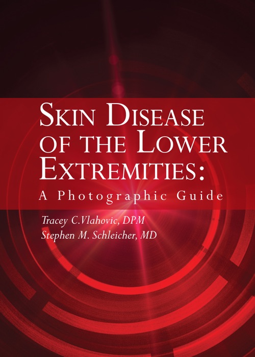 Skin Disease Of The Lower Extremities: A Photographic Guide