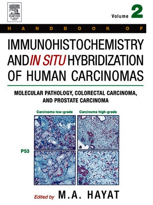 Handbook of Immunohistochemistry and in Situ Hybridization of Human Carcinomas