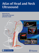 Atlas of Head and Neck Ultrasound - Heinrich Iro, Alessandro Bozzato & Johannes Zenk