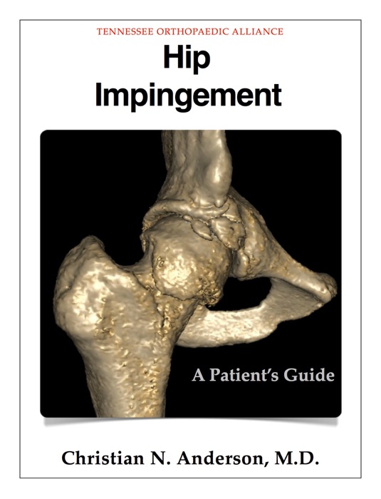 Hip Impingement