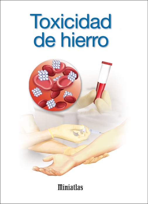 Toxicidad de hierro