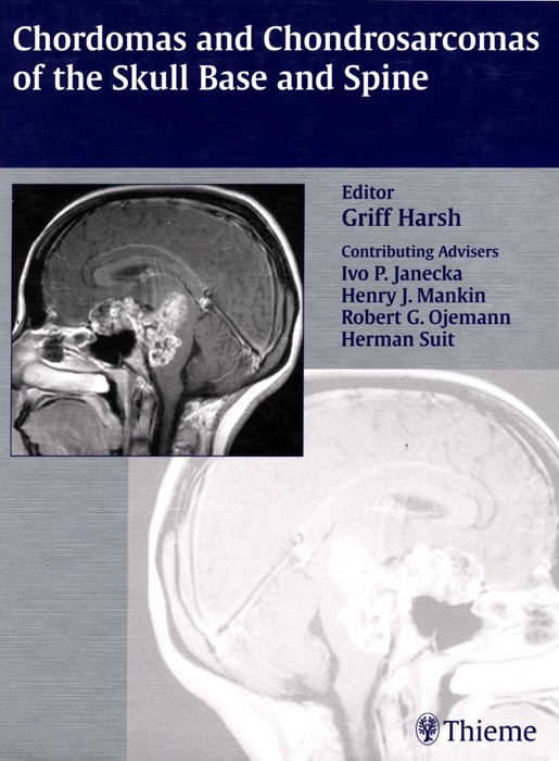 Chordomas and Chondrosarcomas of the Skull Base and Spine