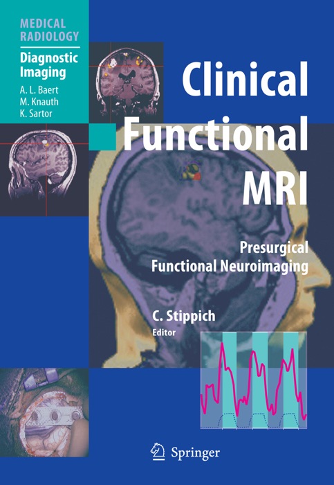 Clinical Functional MRI