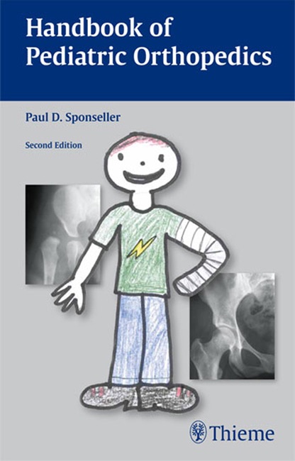 Handbook of Pediatric Orthopedics