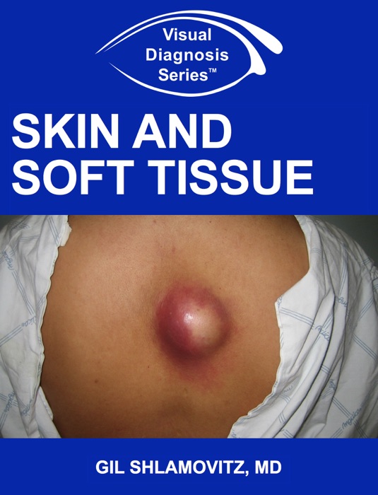 Visual Diagnosis Series: Skin and Soft Tissue