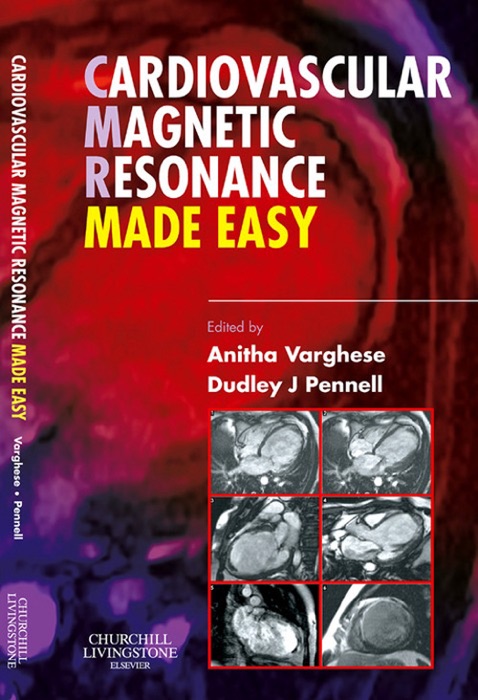 Cardiovascular Magnetic Resonance Made Easy E-Book