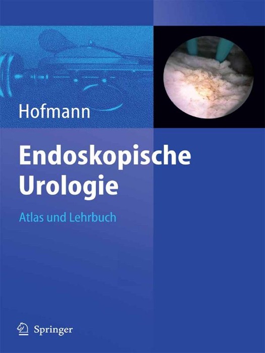 Endoskopische Urologie