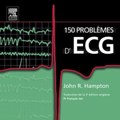 150 problèmes d'ECG - John R. Hampton, François Jan & John Scott & Co