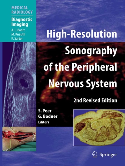 High-Resolution Sonography of the Peripheral Nervous System