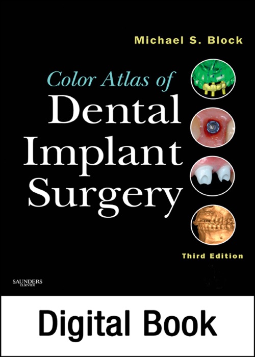 Color Atlas of Dental Implant Surgery - E-Book