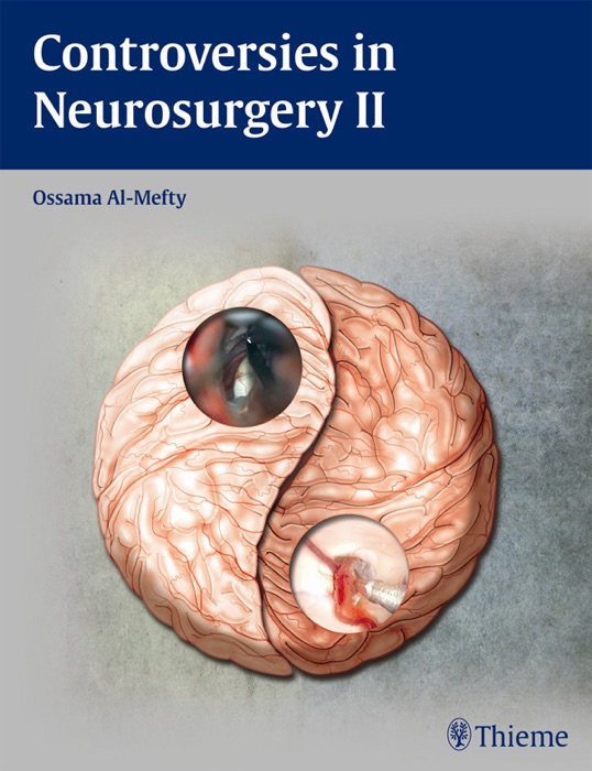 Controversies in Neurosurgery II