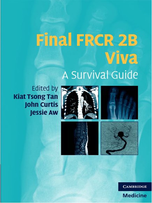 Final FRCR 2B Viva