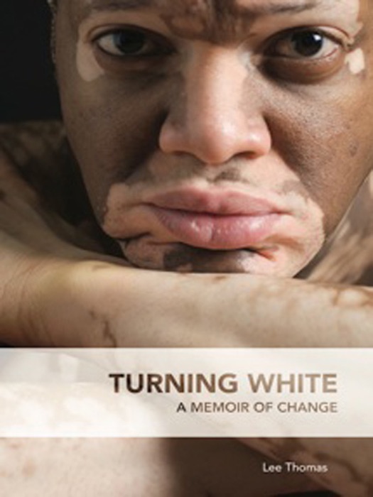 Turning White