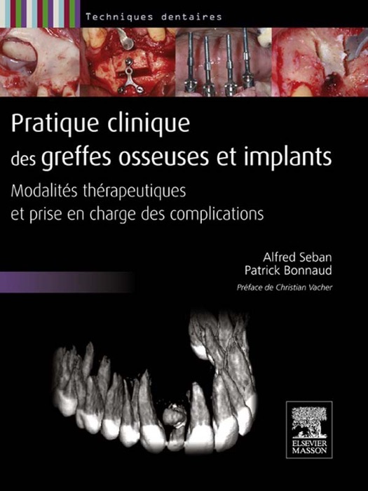 Pratique clinique des greffes osseuses et implants