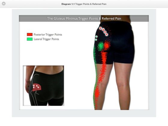 ‎Trigger Point Therapy for the Gluteus Minimus on Apple Books