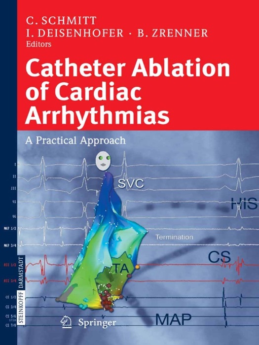 Catheter Ablation of Cardiac Arrhythmias