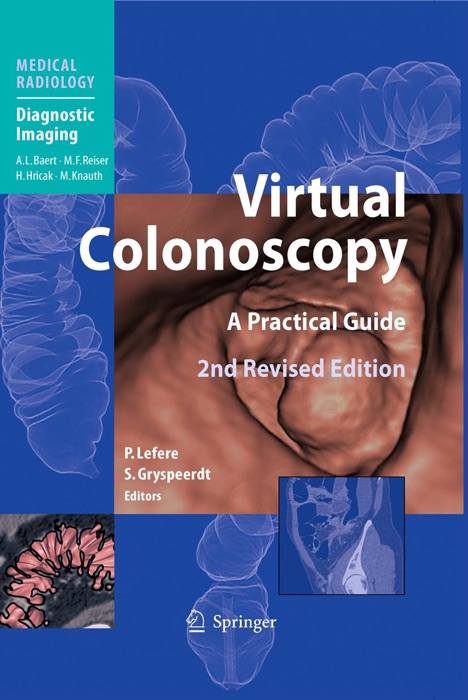 Virtual Colonoscopy