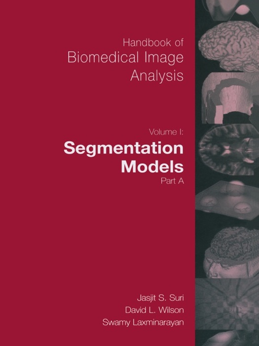 Handbook of Biomedical Image Analysis