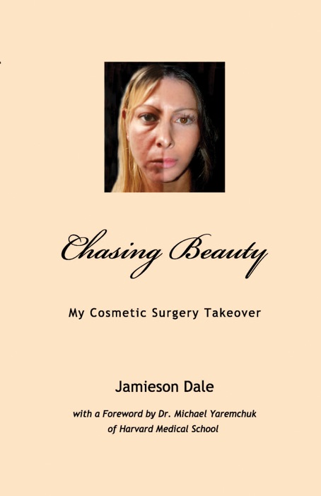 Chasing Beauty
