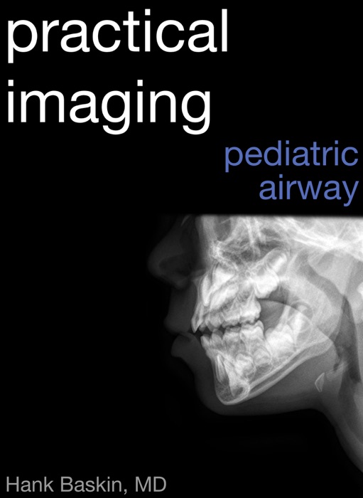 Practical Pediatric Airway Imaging